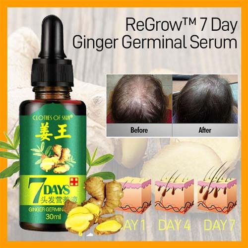 30ML Ginger Hair Growth Oil Hair Care Serum